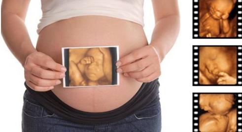 畸形胎、死胎，妈妈孕期只做一件事就可避免！